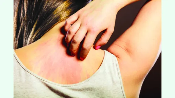 শীতকালে অ্যালার্জি যে কারণে বেড়ে যায়