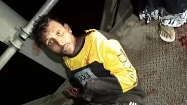 স্বতন্ত্র প্রার্থীর সমর্থকের কবজি কেটে নিল প্রতিপক্ষ