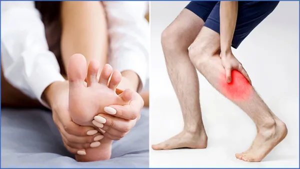 পায়ে ঘন ঘন টান ধরছে, কঠিন রোগের লক্ষণ নয় তো?