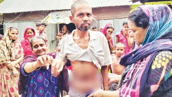 মিল্টন সমাদ্দারের আশ্রমে থাকা যুবকের কিডনির বিষয়ে যা জানালেন চিকিৎসক