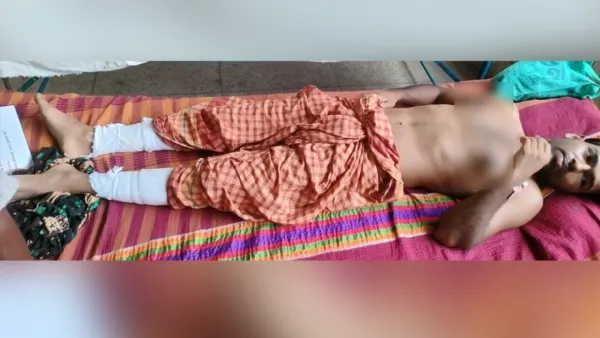 ইউপি সদস্যকে পিটিয়ে পা ভেঙে দিল দুর্বৃত্তরা