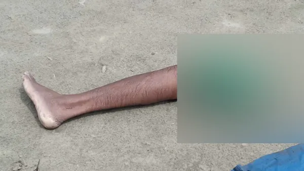 ড্রেন দিয়ে ভেসে যাচ্ছিল মানুষের পা