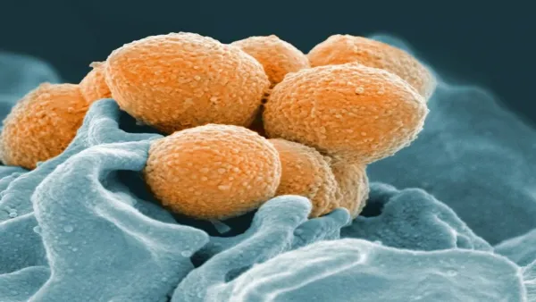 মারাত্মক ‘মাংস খাওয়া’ ব্যাকটেরিয়া ছড়িয়ে পড়ছে জাপানে