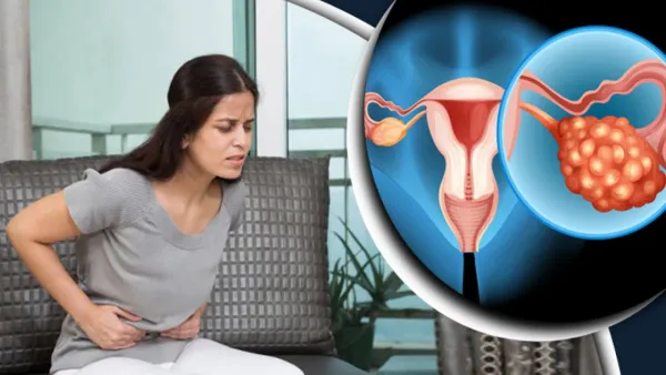 জরায়ুতে সিস্ট, যেসব লক্ষণে বুঝবেন