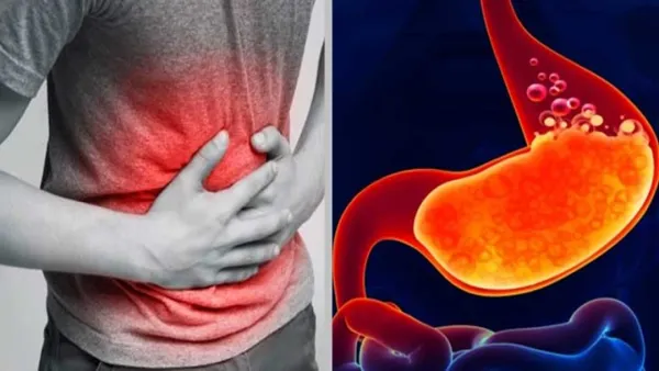 বদহজমের সমস্যা দূর করতে বদলে ফেলুন কিছু অভ্যাস