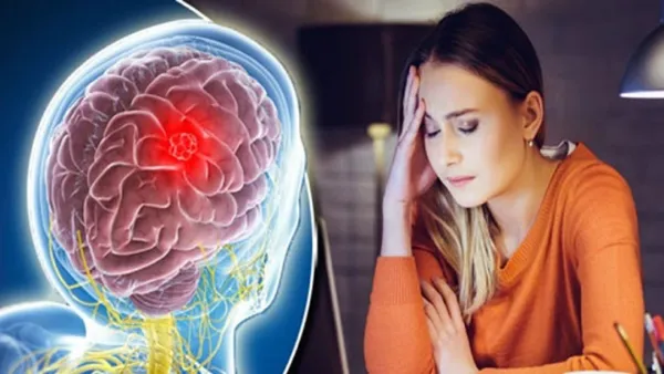 প্রায়ই মাথাব্যথা করছে? ব্রেন টিউমারের লক্ষণ নয় তো!