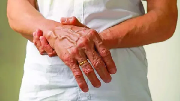 যে লক্ষণগুলোয় বোঝা যায় মিনি স্ট্রোক