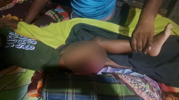 শিয়ালের কামড়ে নারী ও শিশুসহ আহত ৯