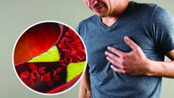কোলেস্টেরল নিয়ন্ত্রণে না রাখলেই বিপদ