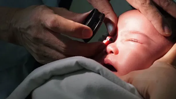 নবজাতকের অন্ধত্ব নিরাময়ে যে চিকিৎসা