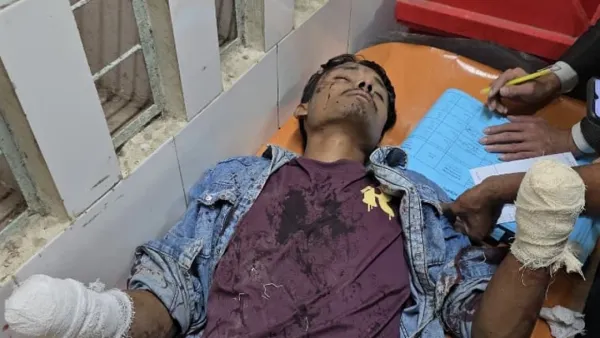 যুবকের দুই হাতের কব্জি কেটে দিল দুর্বৃত্তরা