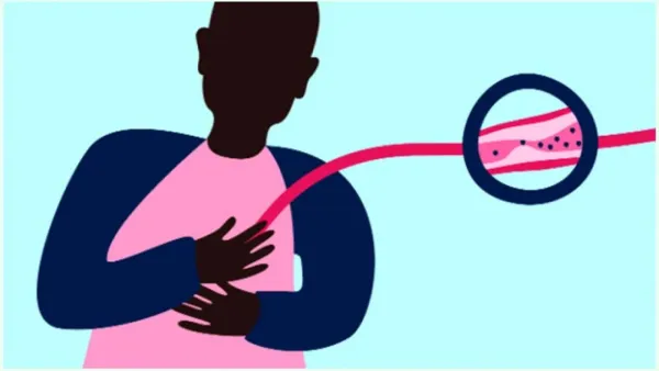 ইসকেমিক হার্ট ডিজিস যে কারণে হয়