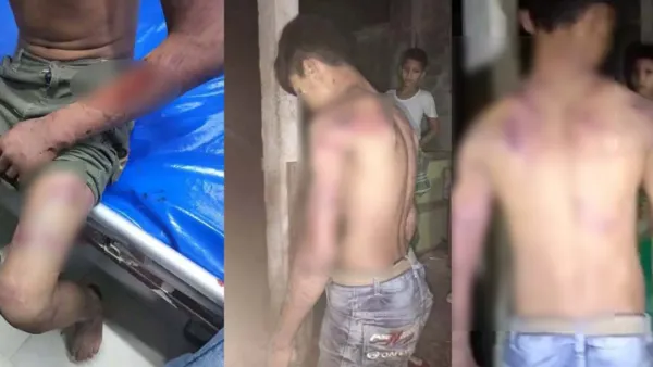 রামুতে চুরির অভিযোগে চোখ বেঁধে কিশোরকে নির্যাতন