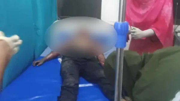 উত্তরায় প্রশিক্ষণ বিমান বিধ্বস্তে দগ্ধ ২৬ জন বার্ন ইনস্টিটিউটে 