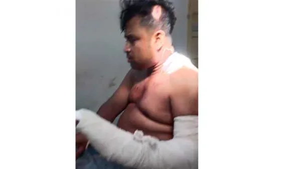 সন্ত্রাসী হামলায় যুবদল নেতার হাতের কব্জি বিচ্ছিন্ন 