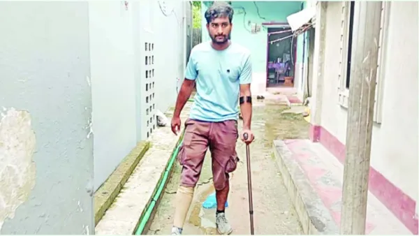 একটা চাকরি প্রয়োজন পা হারানো দিলদারের