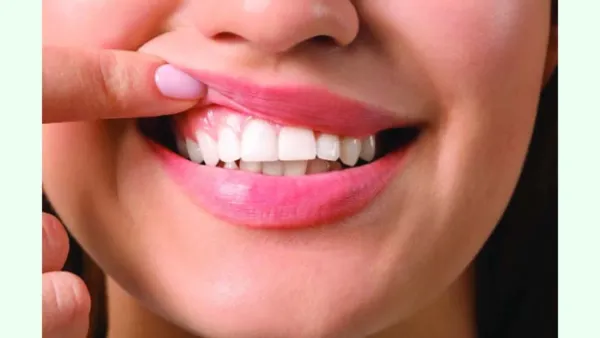 ডায়াবেটিস রোগীর দাঁত ও মাড়ির সমস্যা মোকাবিলায় যা করবেন