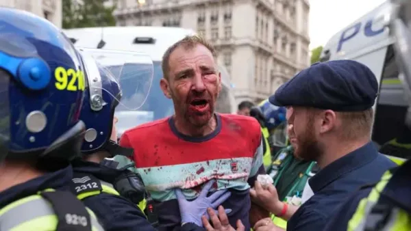 অভিবাসনবিরোধী বিক্ষোভে রক্তাক্ত লন্ডন