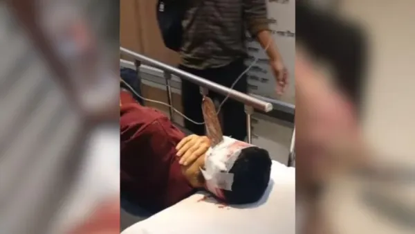 ঘাস কাটা মেশিনের ব্লেড ছিটকে মাথায় ঢুকল যুবকের  