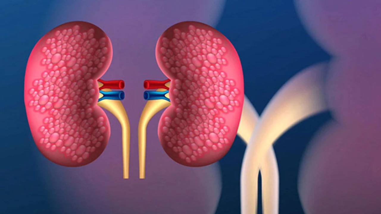 ৮ লক্ষণ দেখে জেনে নিন আপনার কিডনি ভালো আছে কি না