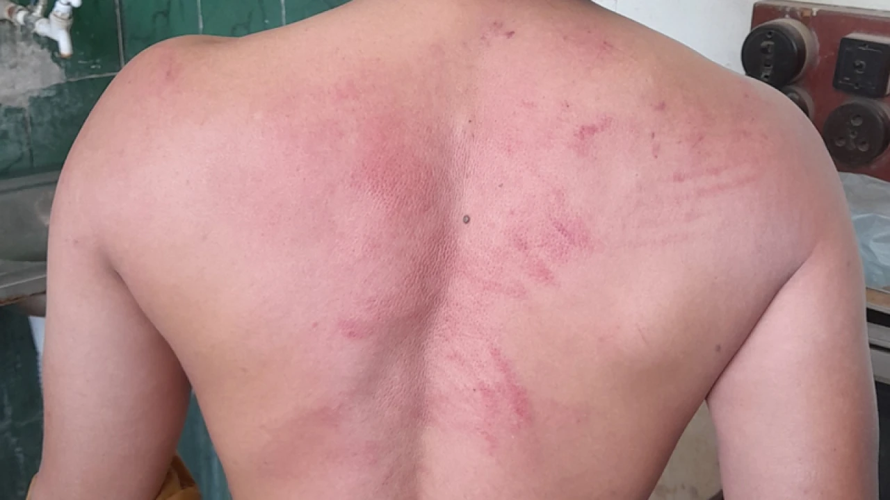 রোগীর ছেলেকে কক্ষে আটকে পেটালেন ইন্টার্ন চিকিৎসকরা