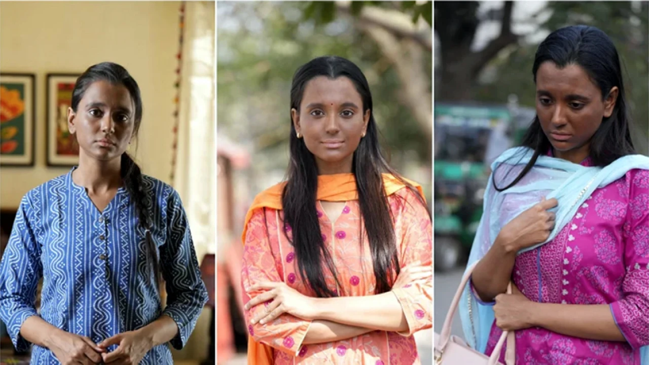 অভিনেত্রীর একি হাল!