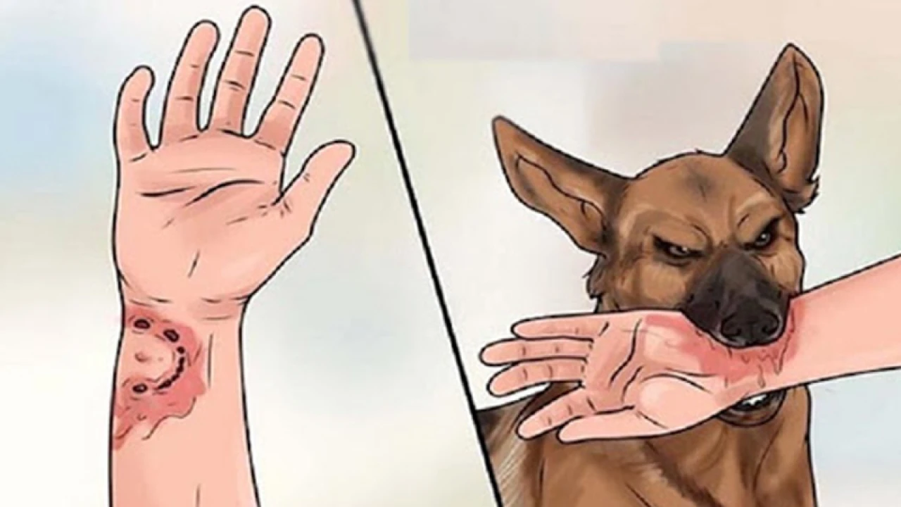 কুকুরের কামড়ে শিশুসহ আহত ২০