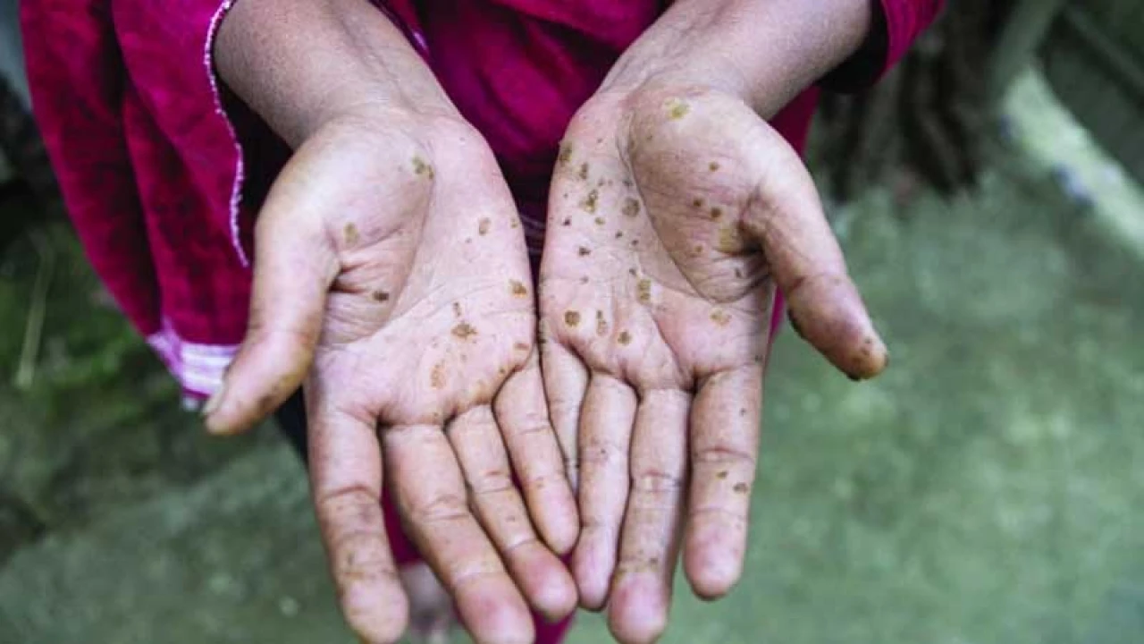 দেশের ১১ ভাগ মানুষ আর্সেনিক দূষণের ঝুঁকিতে