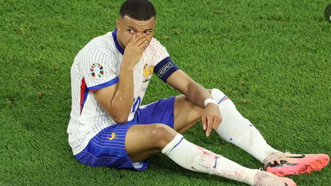 যেভাবে নাক ভাঙল এমবাপ্পের