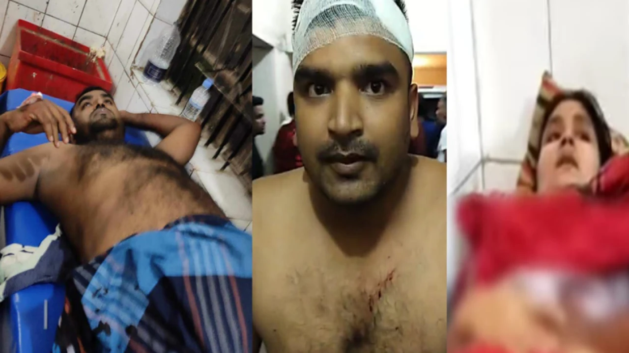 পশুর হাট নিয়ে দ্বন্দ্বে ইউপি চেয়ারম্যানসহ ৭ জনকে কুপিয়ে জখম