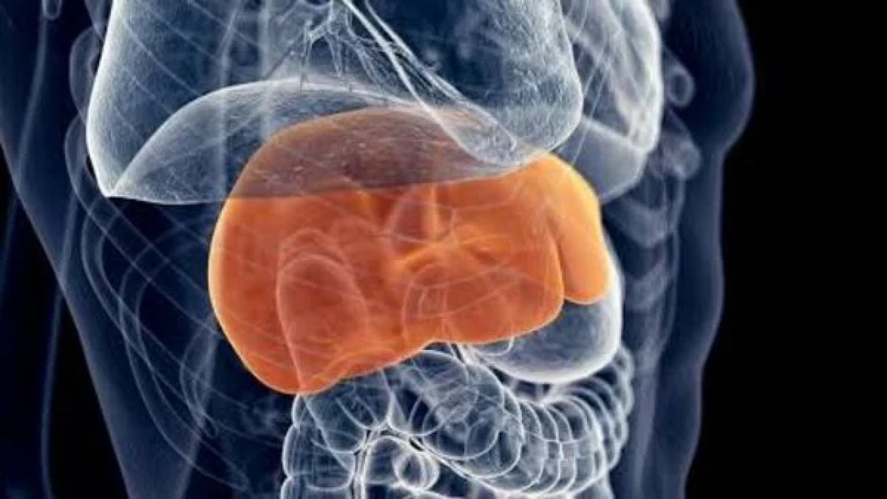 ফ্যাটি লিভার ডিজিজ প্রতিরোধ করবেন যেভাবে