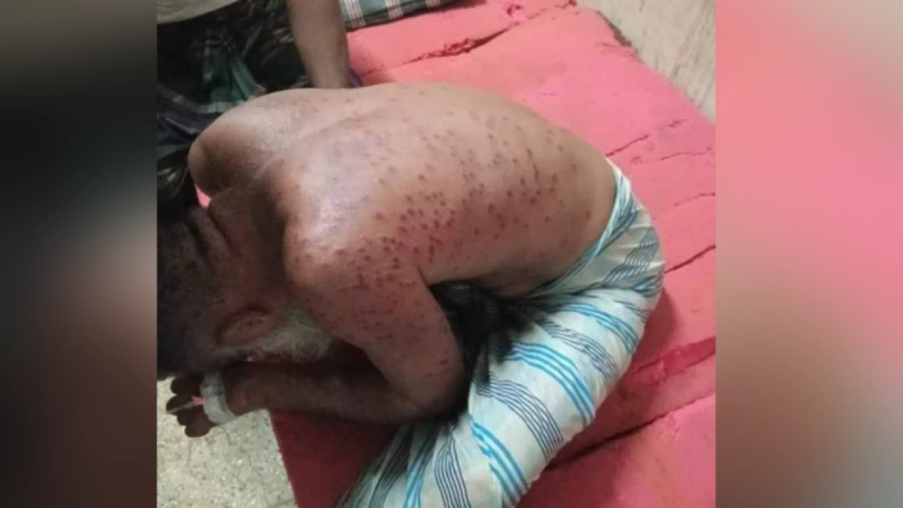 ভিমরুলের কামড়ে প্রাণ গেল বাবা-মেয়ের