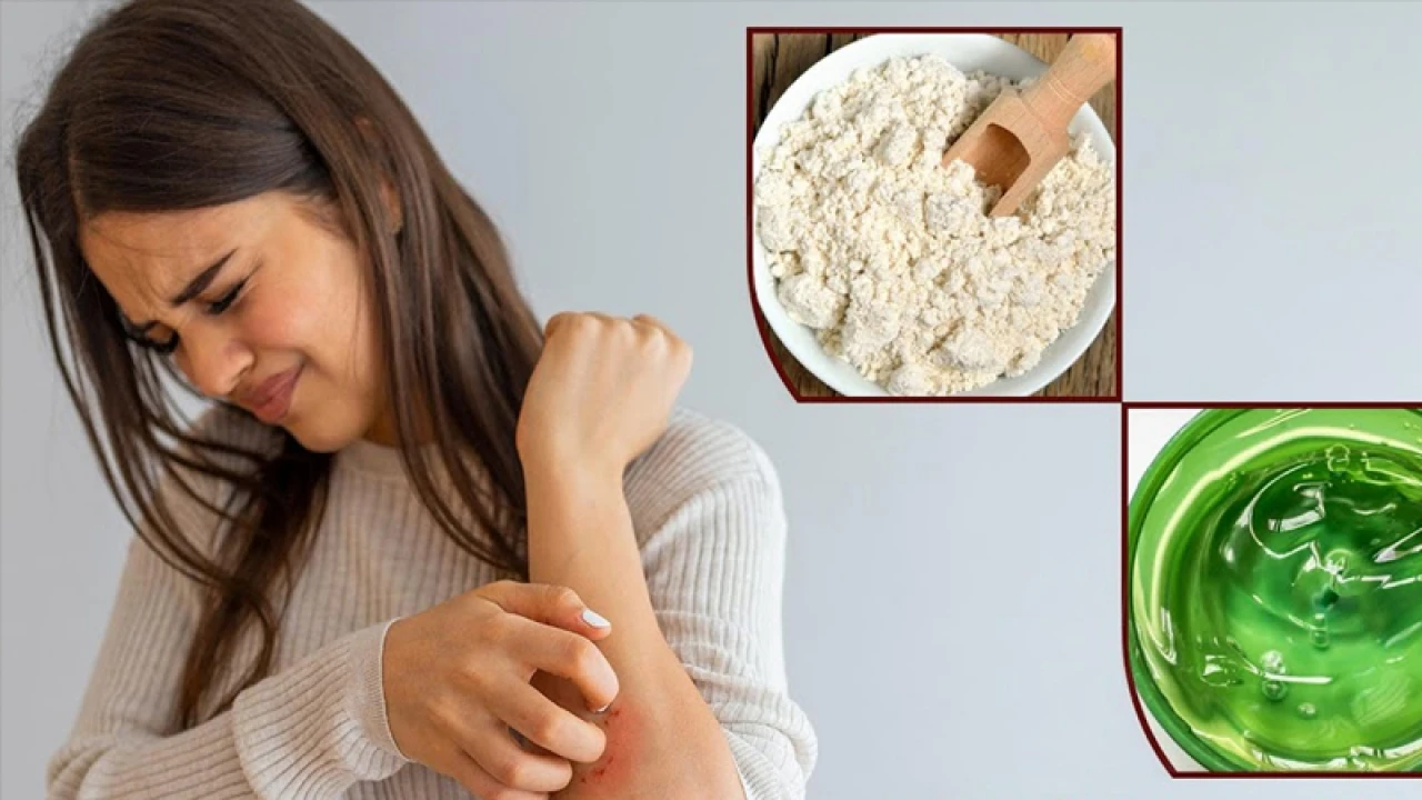 অ্যালার্জিতে অস্থির? ঘরোয়া উপায়ে মিলবে সমস্যার সমাধান!