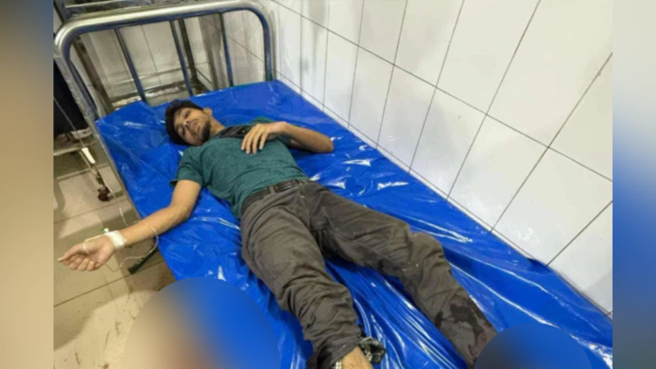 ঢাবিতে মোটরসাইকেলের ধাক্কায় পা ভাঙল ছাত্রের