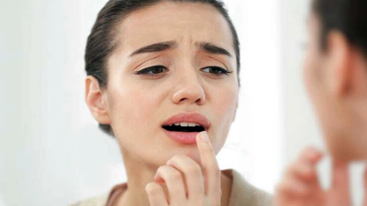 শীত আসার আগেই ঠোঁট ফাটছে? জানুন সমাধান