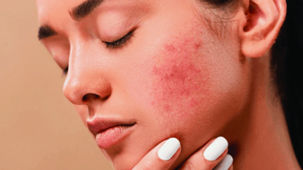 শীতে ত্বক বেশি চুলকানোর কারণ ও চিকিৎসা