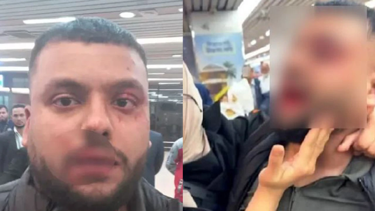 বিমানবন্দরে নিরাপত্তাকর্মীর পিটুনিতে রক্তাক্ত প্রবাসী, গুনলেন জরিমানাও