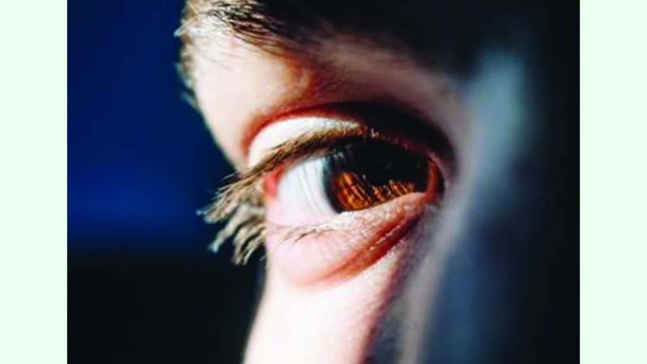 চোখের সংক্রমণ থেকে নিজেকে বাঁচাবেন যেভাবে 