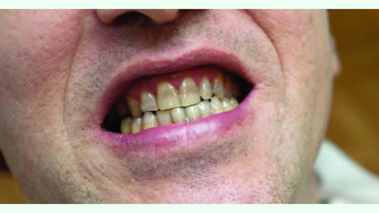 দাঁত ও মুখগহ্বরের যত্ন নেবেন যেভাবে