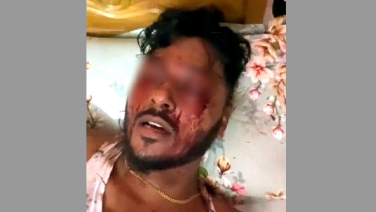 শীর্ষ সন্ত্রাসী রাসেলের চোখ উপড়ে দিলো সহযোগীরা