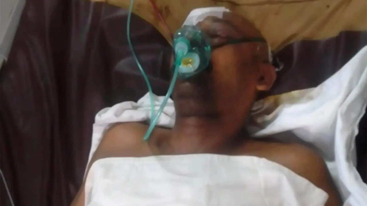 দুলাভাইয়ের মাথার হাড়ের টুকরো পকেটে নিয়ে ঘুরছেন শ্যালক!