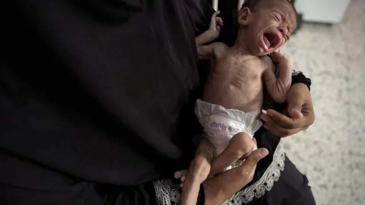 শিশু খাদ্যের চরম সংকট, অনাহারে ফিলিস্তিনি নবজাতকরা