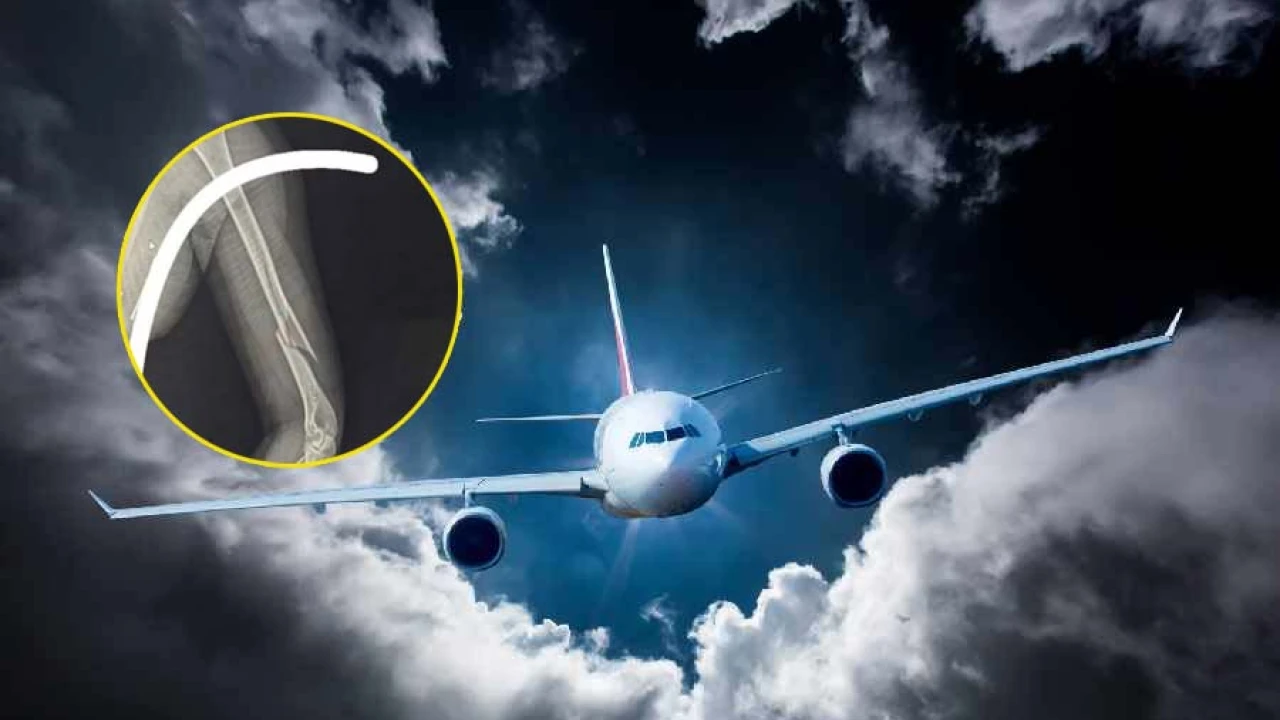 গুরুতর আহত বিমানের কেবিন ক্রু