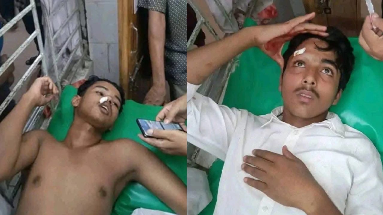 ফুটবল খেলায় হেরে ক্ষিপ্ত হয়ে হামলা, আহত ১০