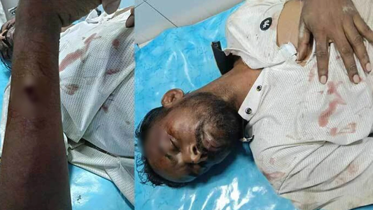 হিরো আলমের ওপর হামলা, অবস্থা গুরুতর