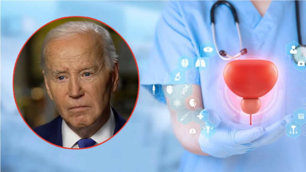 চলছে রেডিয়েশন থেরাপি