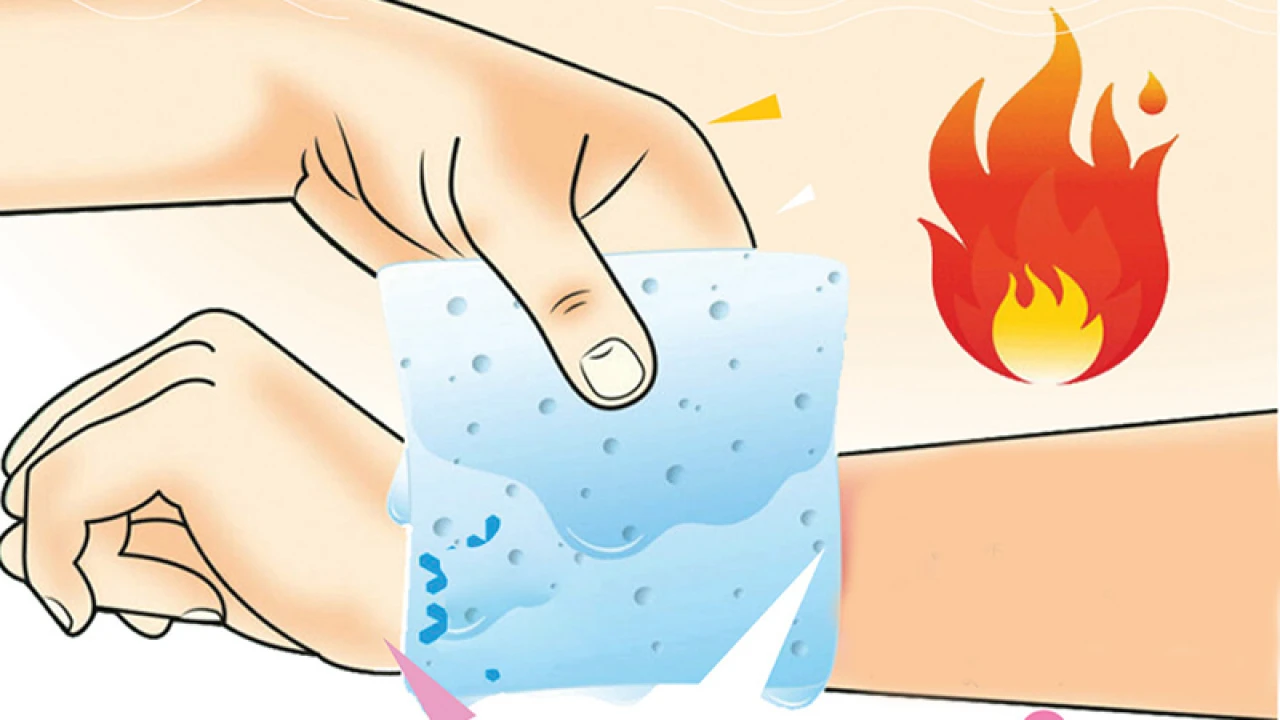 ত্বক পুড়ে গেলে আপনি যা করবেন এবং সতর্ক হবেন